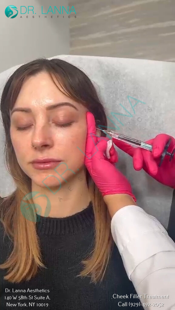 a woman getting cheek fillers