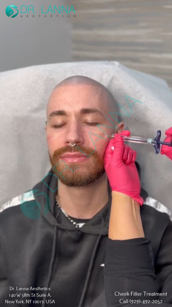 Bearded male cheek filler client receiving a wipe-down at Dr. Lanna Aesthetics, NYC