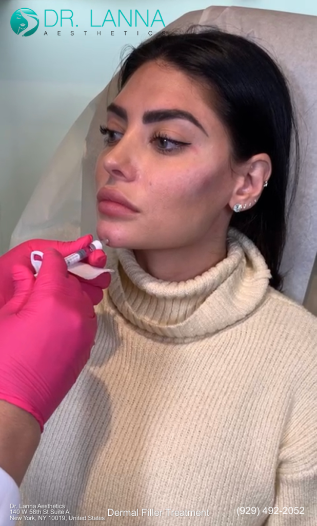 a woman get dermal filler treatment at Dr. Lanna Aesthetics' beauty clinic