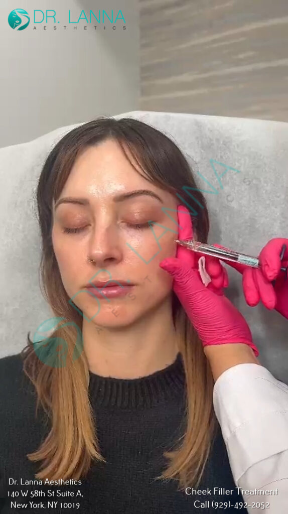 a woman getting cheek filler
