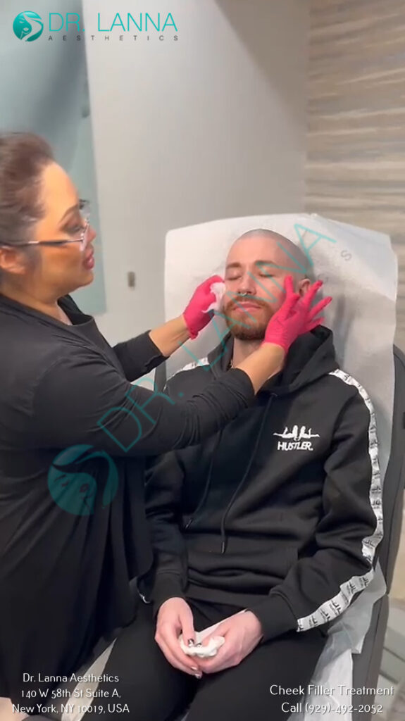 a man received cheek filler injection at Dr. Lanna's clinic