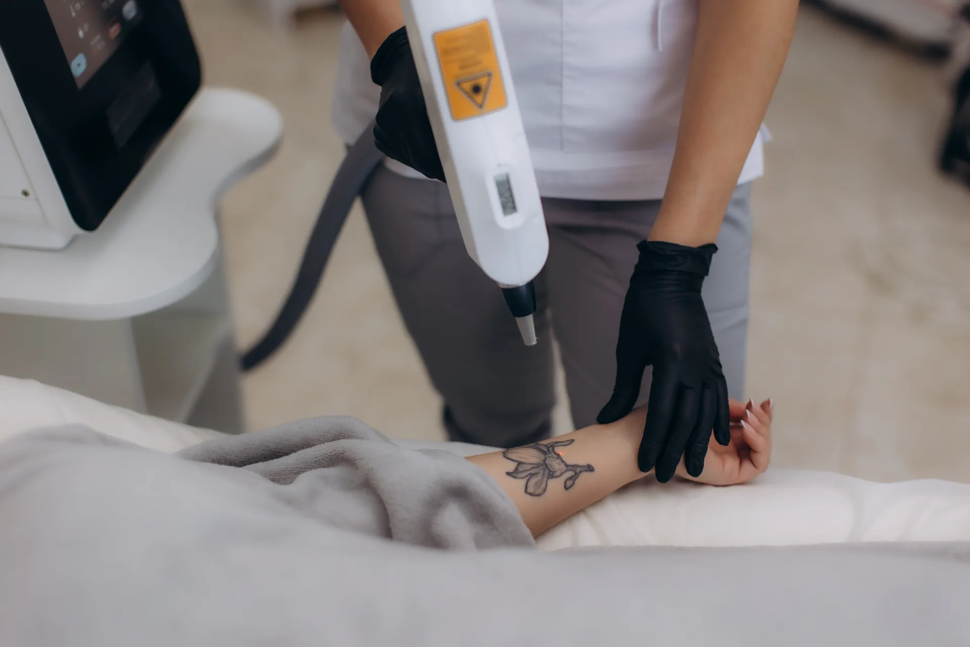 Laser Tattoo Removal at Dr. Lanna Aesthetics