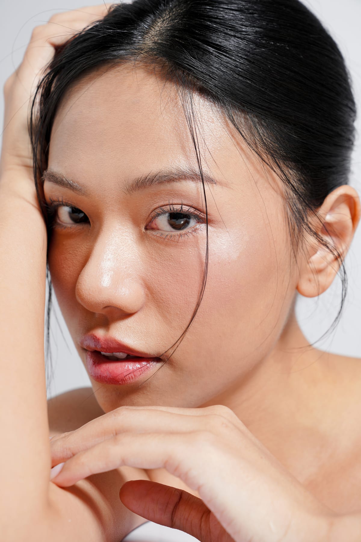 Sculptra in NYC technique